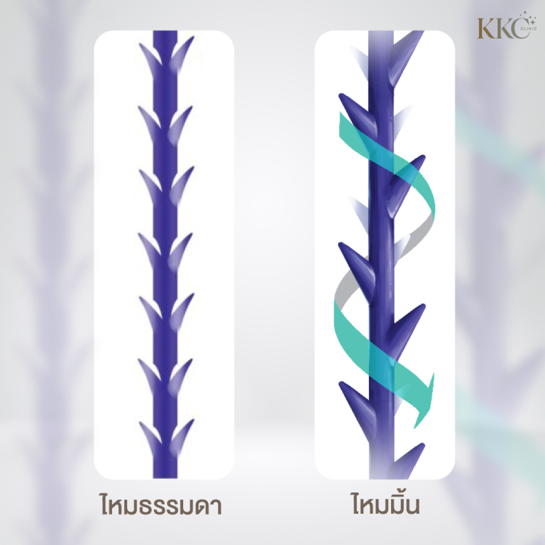 เปรียบเทียบเส้นไหมธรรมดากับไหมมินต์ โดยไหมมินต์มีลักษณะเกลียวเพื่อเพิ่มประสิทธิภาพการยกกระชับ