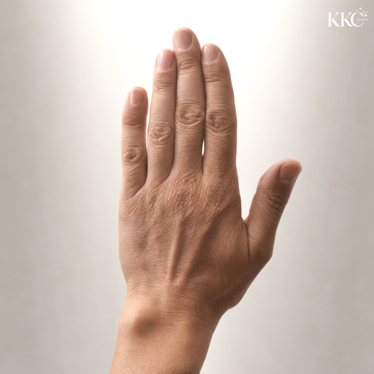ภาพระยะใกล้ของหลังมือที่มีริ้วรอยและความแห้งกร้าน สื่อถึงผิวมือที่เหี่ยวย่น