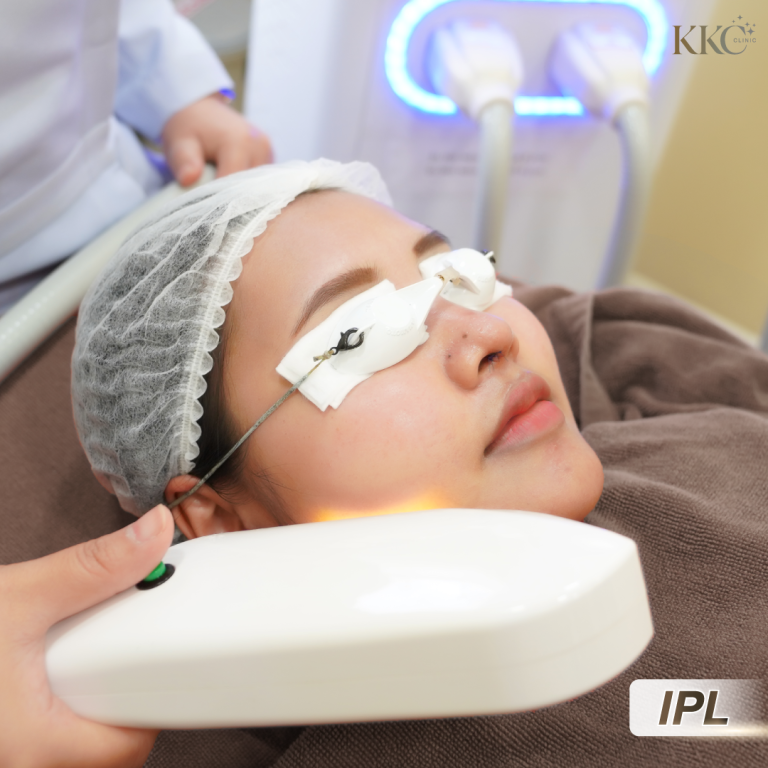 ขณะทำทรีตเมนต์ IPL บนใบหน้า ผู้รับบริการใส่อุปกรณ์ป้องกันตาและนอนบนเตียงทรีตเมนต์