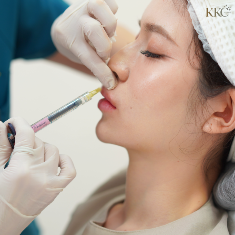 แพทย์กำลังฉีดฟิลเลอร์ Restylane บริเวณร่องแก้มให้คนไข้หญิง