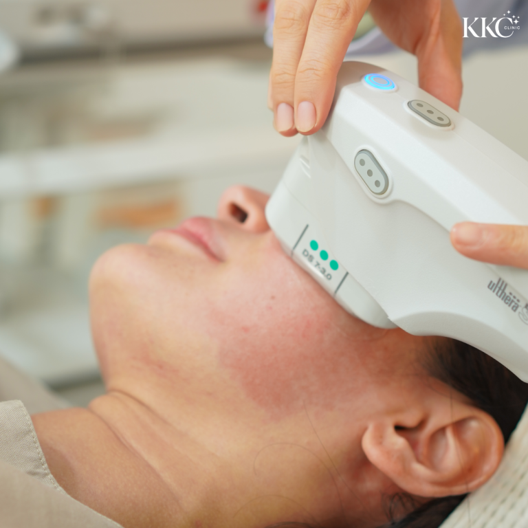 ภาพระยะใกล้ของการทำ Ultherapy บริเวณแนวกรามและใบหน้าล่างของผู้รับบริการ