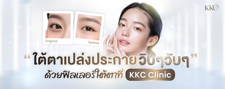 ภาพผู้หญิงพร้อมเปรียบเทียบใต้ตาก่อนและหลังฉีดฟิลเลอร์ พร้อมข้อความโปรโมทการฉีดฟิลเลอร์ใต้ตาที่ KKC Clinic
