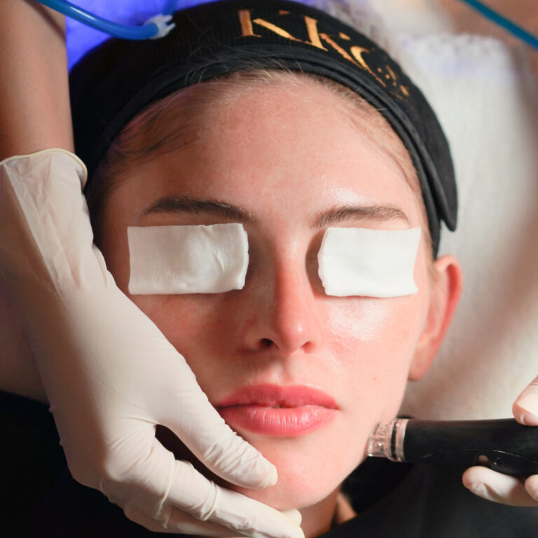 Microdermabrasion Alternative in Bangkok