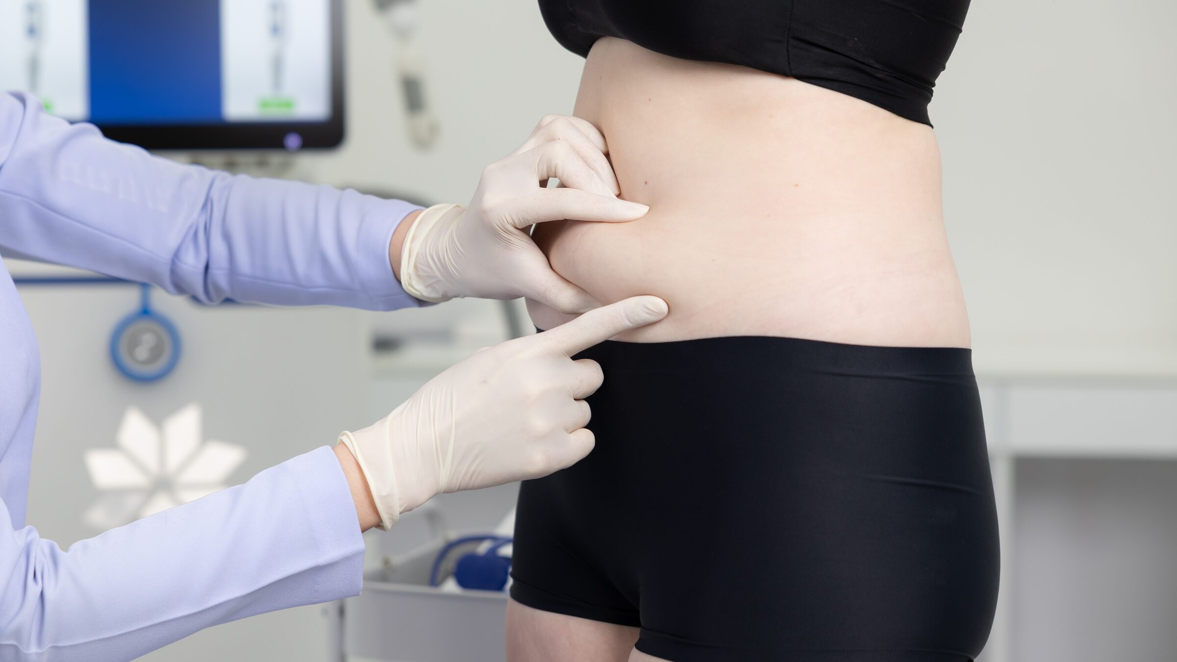 A nurse pinches a fold of fat on a client’s abdomen